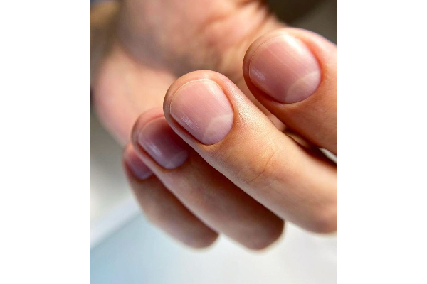 ناخنکده پروین رفیعی